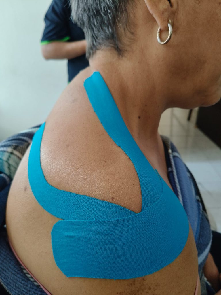 Clase de neurovendaje